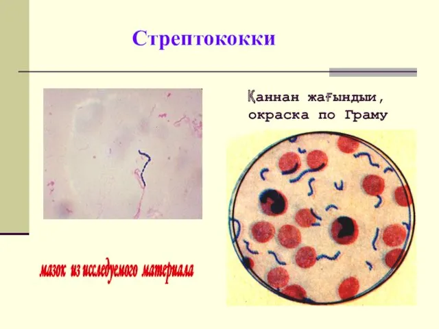 Стрептококки Қаннан жағындыи, окраска по Граму мазок из исследуемого материала