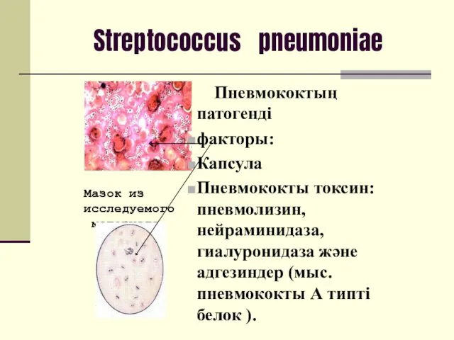 Streptococcus pneumoniae Пневмококтың патогенді факторы: Капсула Пневмококты токсин: пневмолизин, нейраминидаза,