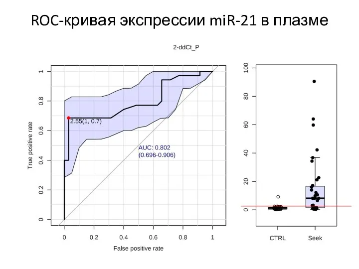 ROC-кривая экспрессии miR-21 в плазме