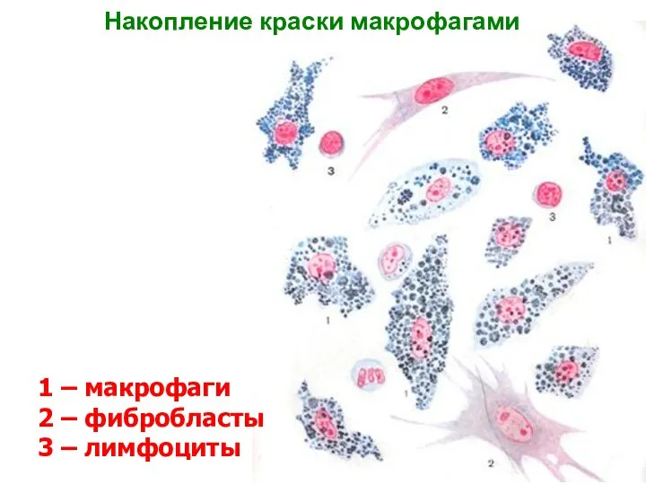 Накопление краски в макрофагах РВСТ 1 – макрофаги 2 – фибробласты 3 –