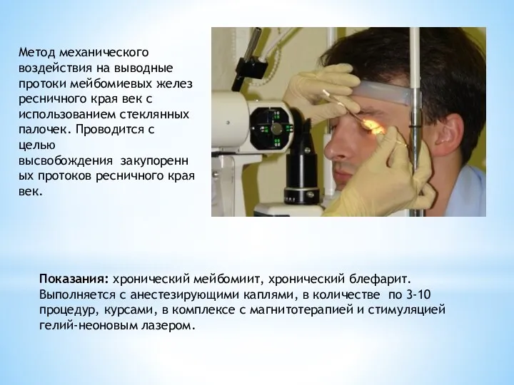 Метод механического воздействия на выводные протоки мейбомиевых желез ресничного края