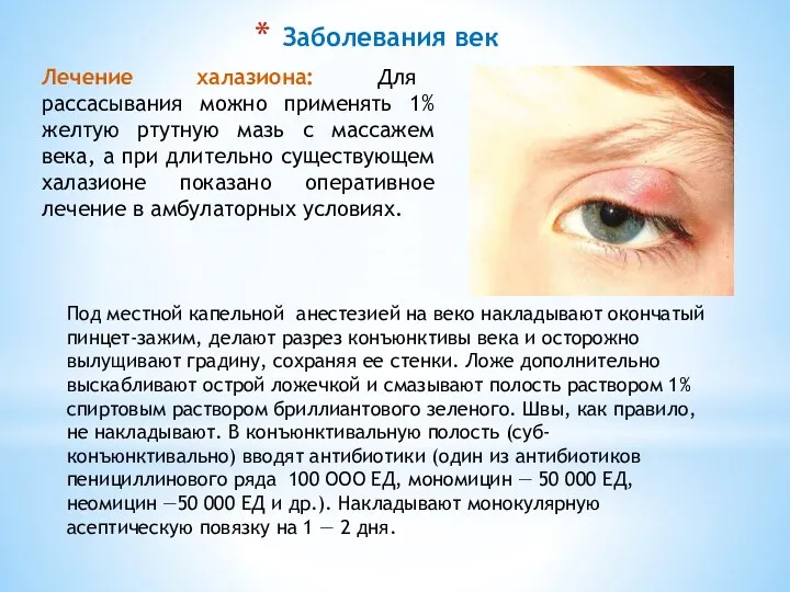 Заболевания век Под местной капельной анестезией на веко накладывают окончатый
