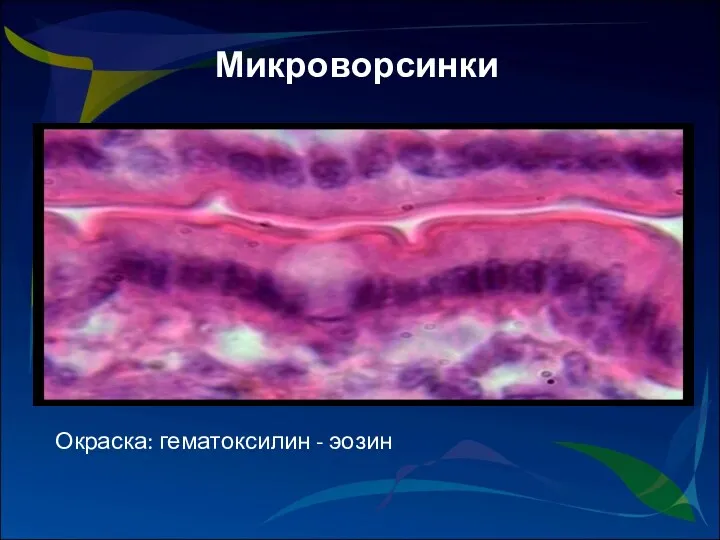 Микроворсинки Окраска: гематоксилин - эозин