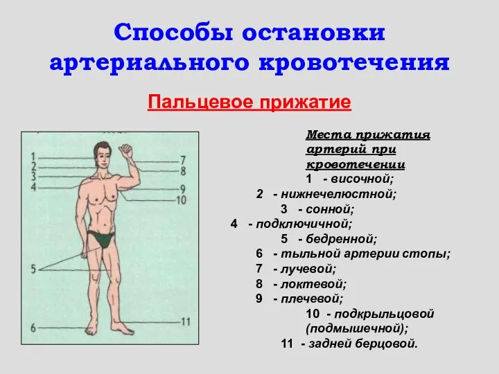 Способы остановки артериального кровотечения Пальцевое прижатие Места прижатия артерий при