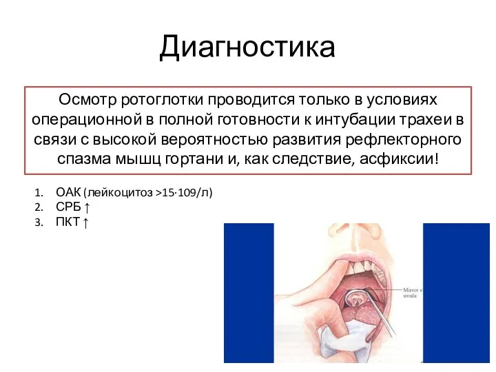 Диагностика Осмотр ротоглотки проводится только в условиях операционной в полной