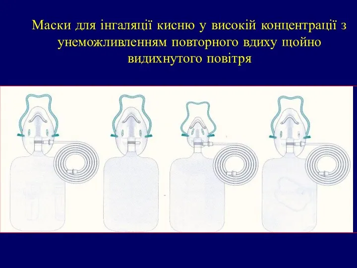 Маски для інгаляції кисню у високій концентрації з унеможливленням повторного вдиху щойно видихнутого повітря