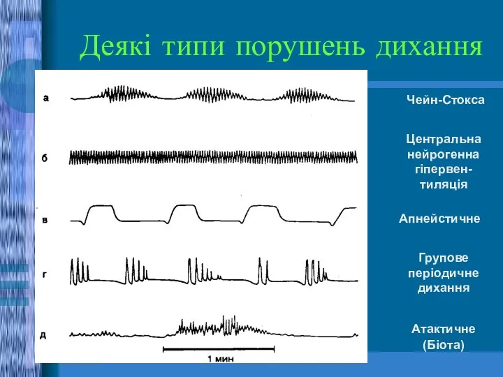 Деякі типи порушень дихання Чейн-Стокса Центральна нейрогенна гіпервен-тиляція Апнейстичне Групове періодичне дихання Атактичне (Біота)