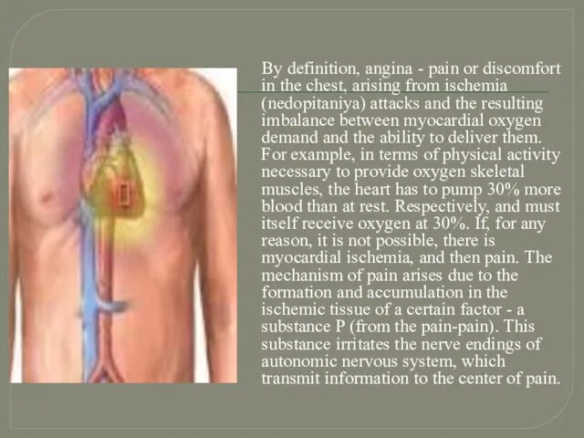 By definition, angina - pain or discomfort in the chest,