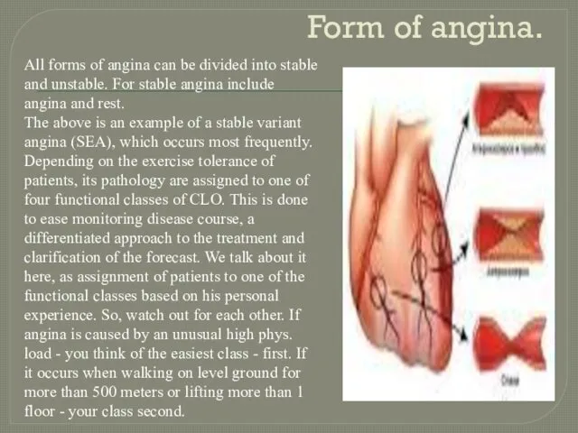 Form of angina. All forms of angina can be divided