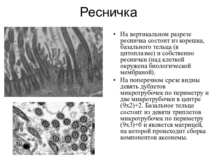 Ресничка На вертикальном разрезе ресничка состоит из корешка, базального тельца