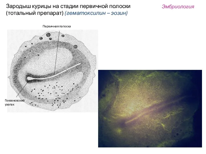 Гензеновский узелок Первичная полоска Зародыш курицы на стадии первичной полоски (тотальный препарат) (гематоксилин – эозин) Эмбриология