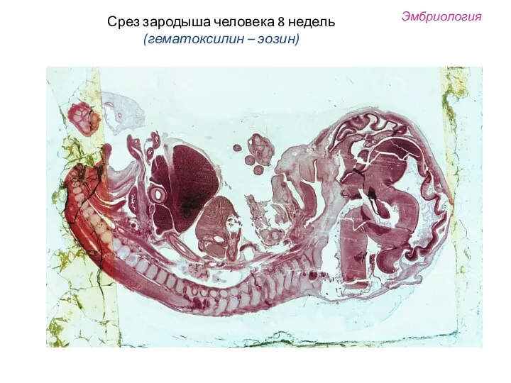 Срез зародыша человека 8 недель (гематоксилин – эозин) Эмбриология