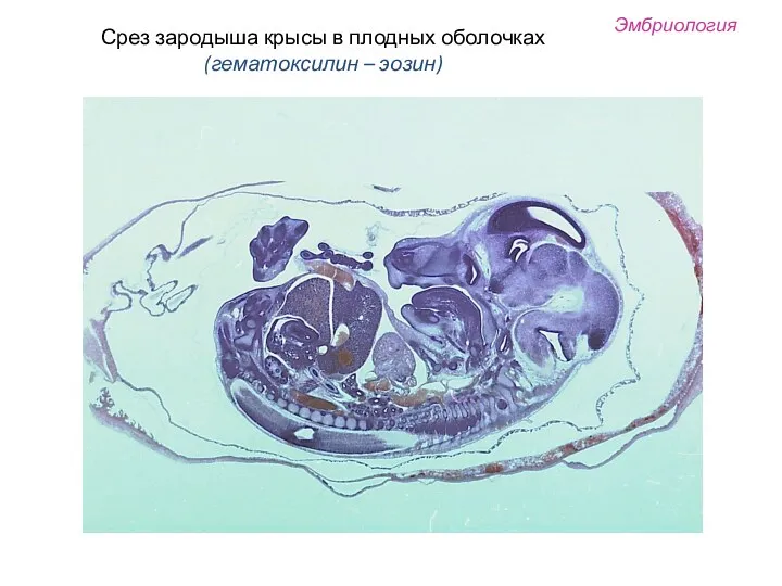 Эмбриология Срез зародыша крысы в плодных оболочках (гематоксилин – эозин)