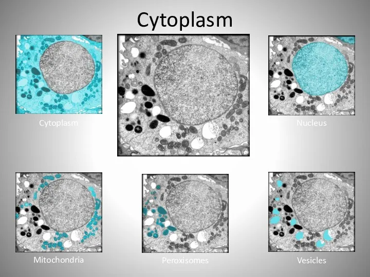 Cytoplasm Cytoplasm Nucleus Mitochondria Peroxisomes Vesicles