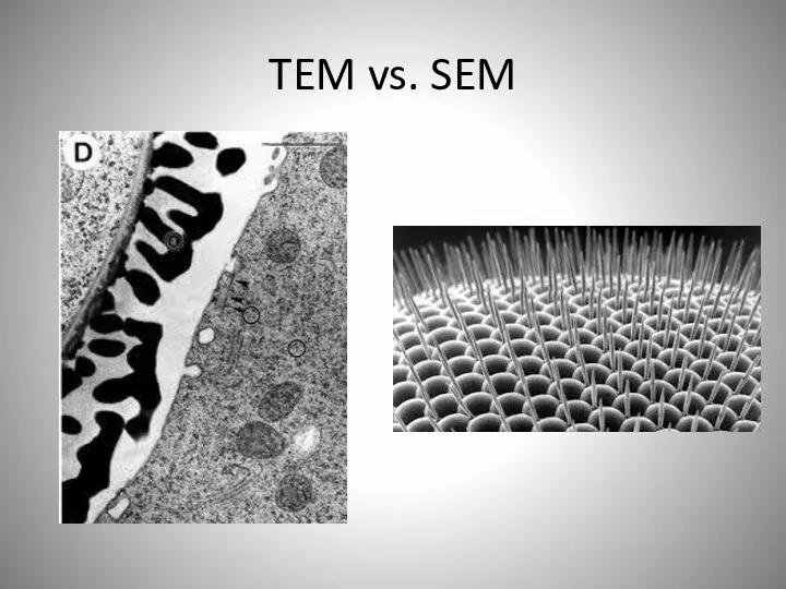 TEM vs. SEM