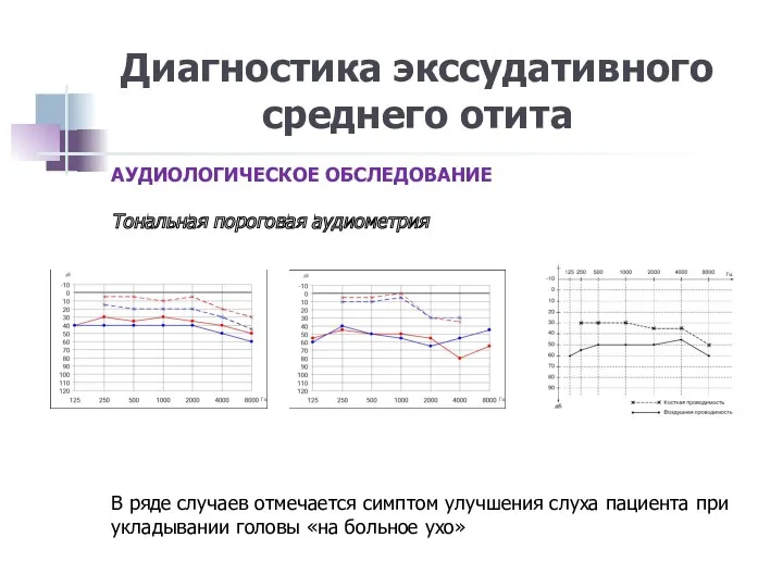 Диагностика экссудативного среднего отита АУДИОЛОГИЧЕСКОЕ ОБСЛЕДОВАНИЕ Тональная пороговая аудиометрия В ряде случаев отмечается