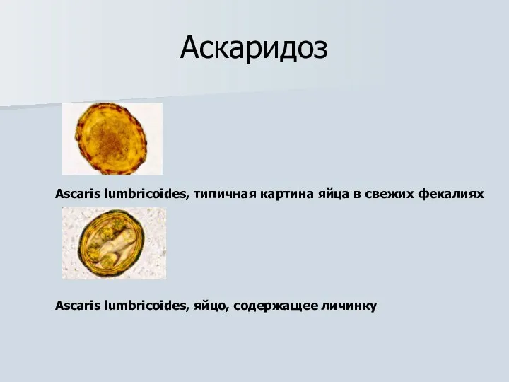 Аскаридоз Ascaris lumbricoides, типичная картина яйца в свежих фекалиях Ascaris lumbricoides, яйцо, содержащее личинку