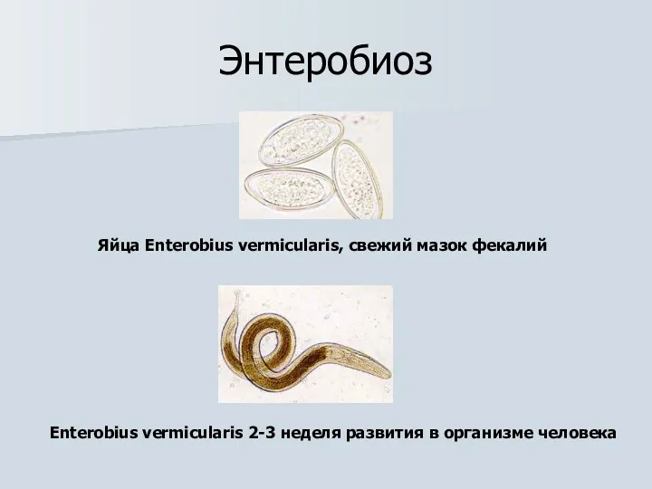 Энтеробиоз Яйца Enterobius vermicularis, свежий мазок фекалий Enterobius vermicularis 2-3 неделя развития в организме человека