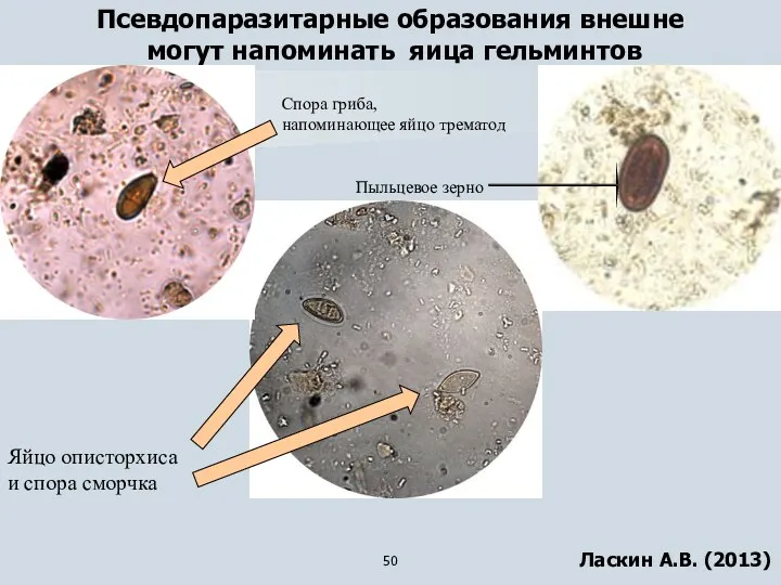 Псевдопаразитарные образования внешне могут напоминать яица гельминтов Спора гриба, напоминающее