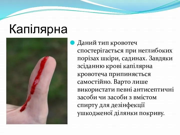 Капілярна Даний тип кровотеч спостерігається при неглибоких порізах шкіри, садинах.