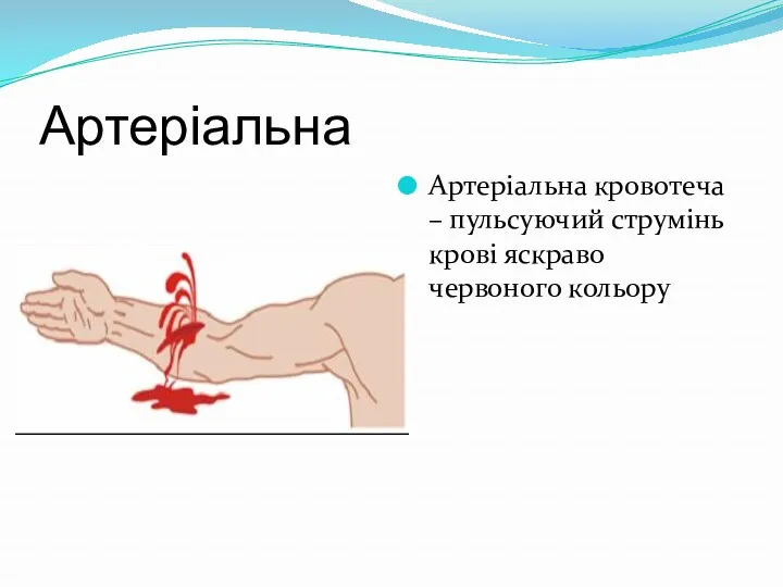 Артеріальна Артеріальна кровотеча – пульсуючий струмінь крові яскраво червоного кольору