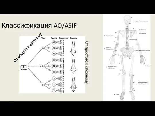 Классификация AO/ASIF От общего к частному От простого к сложному