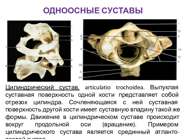 ОДНООСНЫЕ СУСТАВЫ Цилиндрический сустав, articulatio trochoidea. Выпуклая суставная поверхность одной кости представляет собой