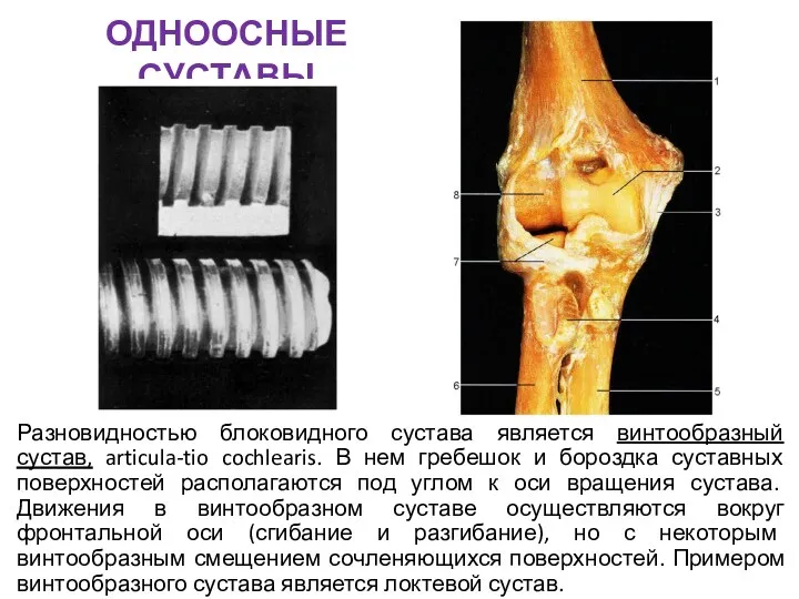 ОДНООСНЫЕ СУСТАВЫ Разновидностью блоковидного сустава является винтообразный сустав, articula-tio cochlearis. В нем гребешок