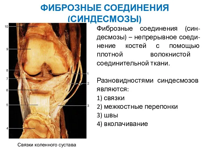 ФИБРОЗНЫЕ СОЕДИНЕНИЯ (СИНДЕСМОЗЫ) Фиброзные соединения (син-десмозы) – непрерывное соеди-нение костей с помощью плотной