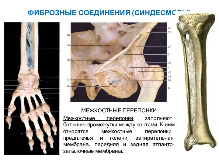 ФИБРОЗНЫЕ СОЕДИНЕНИЯ (СИНДЕСМОЗЫ) МЕЖКОСТНЫЕ ПЕРЕПОНКИ Межкостные перепонки заполняют большие промежутки между костями. К