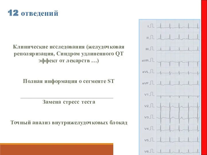 12 отведений Клинические исследования (желудочковая реполяризация, Синдром удлиненного QT эффект