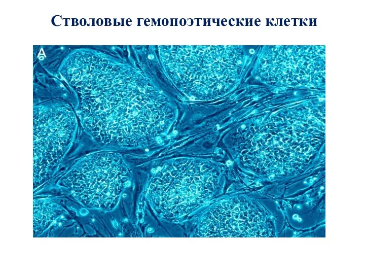 Стволовые гемопоэтические клетки