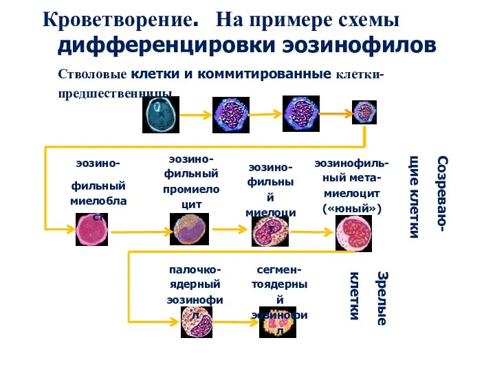 Кроветворение. На примере схемы дифференцировки эозинофилов Стволовые клетки и коммитированные клетки-предшественницы эозинофиль- ный