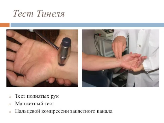 Тест Тинеля Тест поднятых рук Манжетный тест Пальцевой компрессии запястного канала