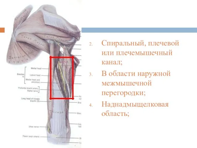 Спиральный, плечевой или плечемышечный канал; В области наружной межмышечной перегородки; Наднадмыщелковая область;
