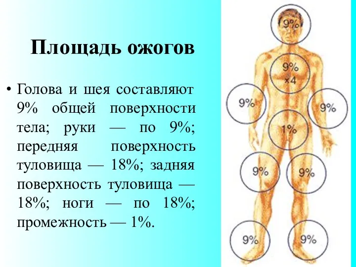 Площадь ожогов Голова и шея составляют 9% общей поверхности тела;