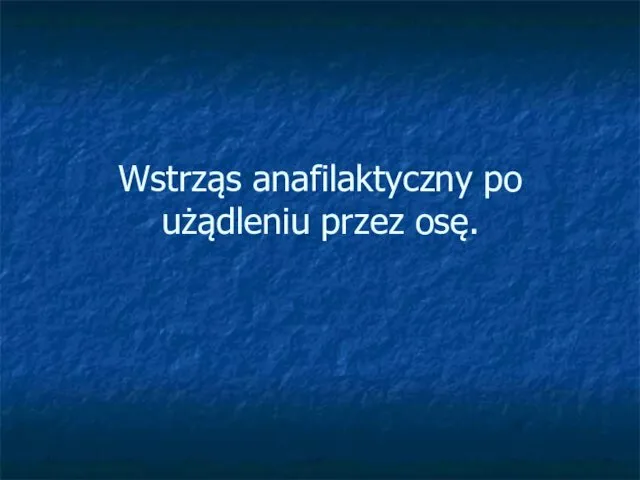 Wstrząs anafilaktyczny po użądleniu przez osę.