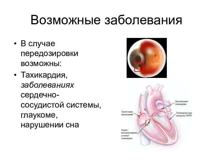 Возможные заболевания В случае передозировки возможны: Тахикардия, заболеваниях сердечно-сосудистой системы, глаукоме, нарушении сна