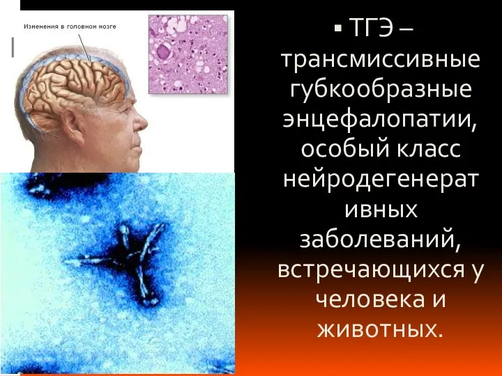 ТГЭ – трансмиссивные губкообразные энцефалопатии, особый класс нейродегенеративных заболеваний, встречающихся у человека и животных.