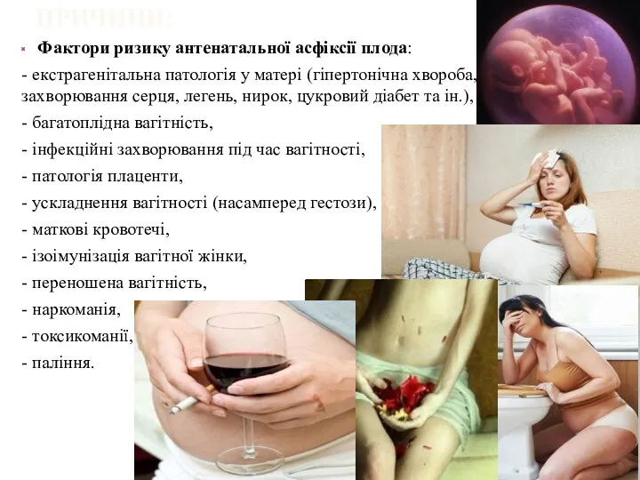 ПРИЧИНИ: Фактори ризику антенатальної асфіксії плода: - eкcтpaгeнітaльнa патологія у матері (гіпертонічна хвороба,