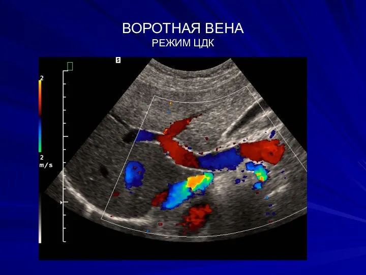 ВОРОТНАЯ ВЕНА РЕЖИМ ЦДК