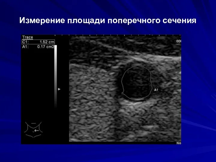 Измерение площади поперечного сечения