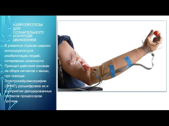 НЕЙРОПРОТЕЗЫ ДЛЯ СОЗНАТЕЛЬНОГО КОНТРОЛЯ ДВИЖЕНИЕМ В развитых странах широко используется