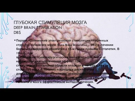 ГЛУБОКАЯ СТИМУЛЯЦИЯ МОЗГА DEEP BRAIN STIMULATION DBS Первое применение электрической