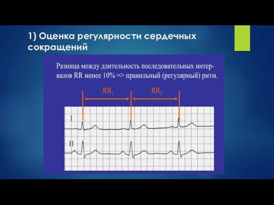 1) Оценка регулярности сердечных сокращений