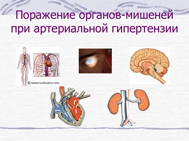 Поражение органов-мишеней при артериальной гипертензии