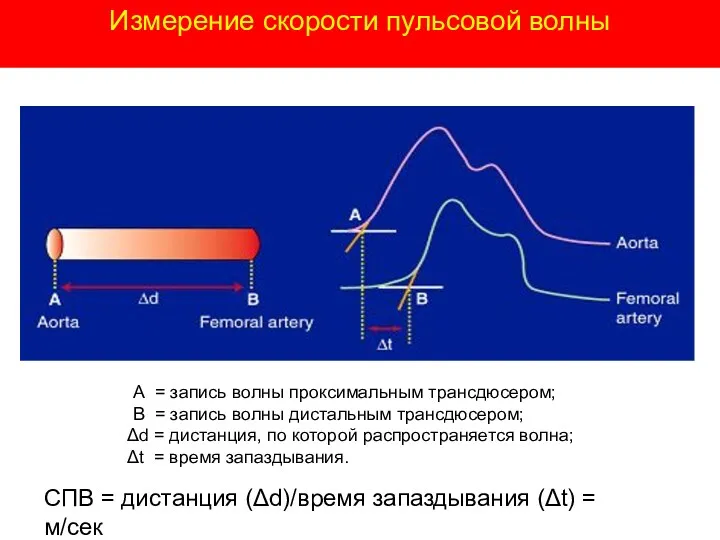 А = запись волны проксимальным трансдюсером; В = запись волны