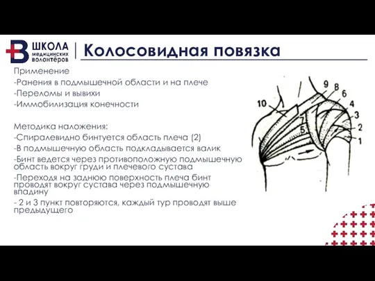 Колосовидная повязка Применение -Ранения в подмышечной области и на плече -Переломы и вывихи