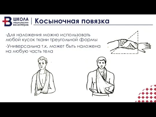 Косыночная повязка -Для наложения можно использовать любой кусок ткани треугольной формы -Универсальна т.к.