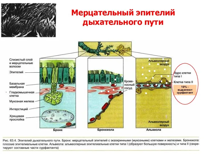10% - выделяют сурфактант Мерцательный эпителий дыхательного пути